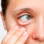 Teste Anemia Lab in the Box