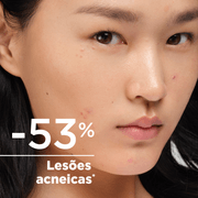 Cel Creme Sébium Kerato+ Tendência Acneica